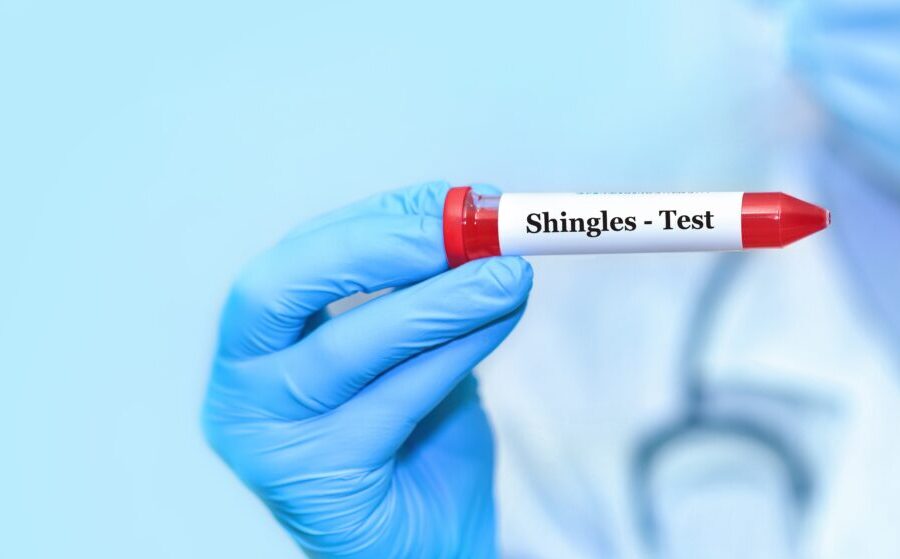 Essential Shingles Advice Image